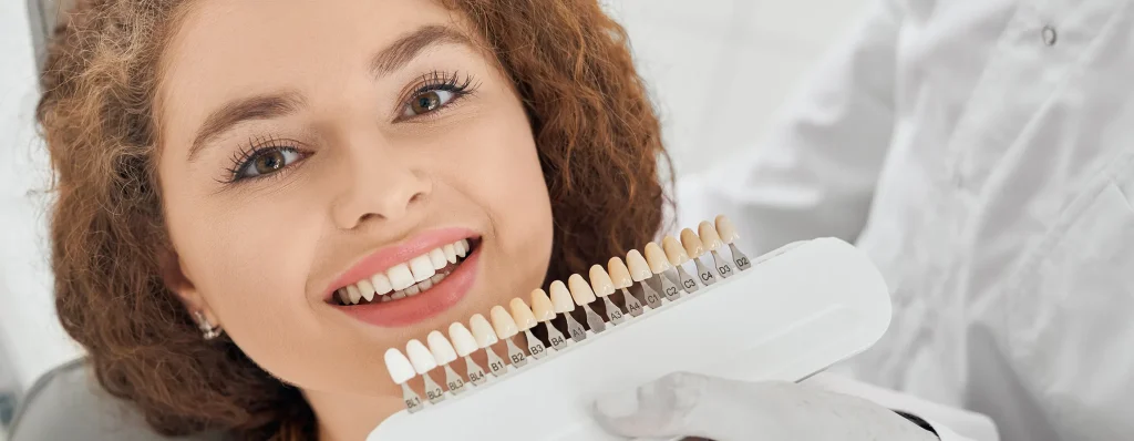 cosa sono le faccette dentali e a cosa servono davvero