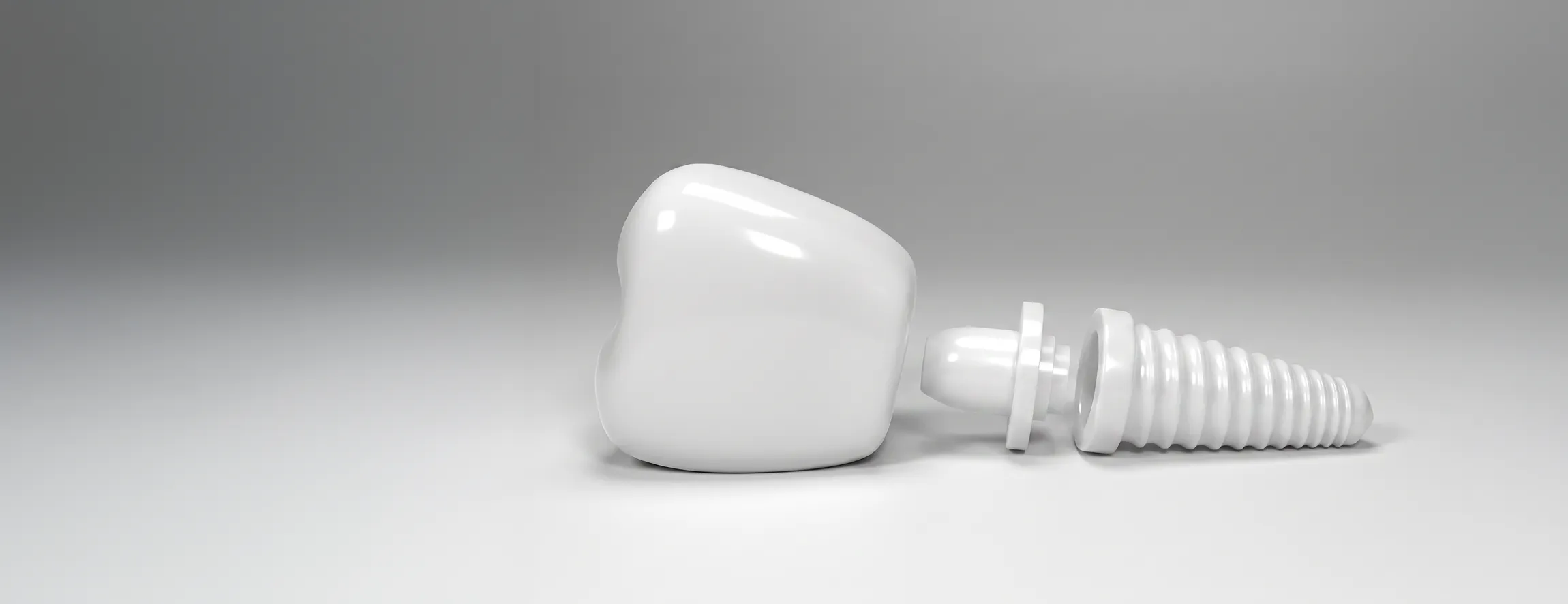 Impianti dentali metal-free cosa significa e per chi sono indicati