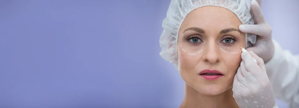 filler viso ridare volume senza cambiare i lineamenti
